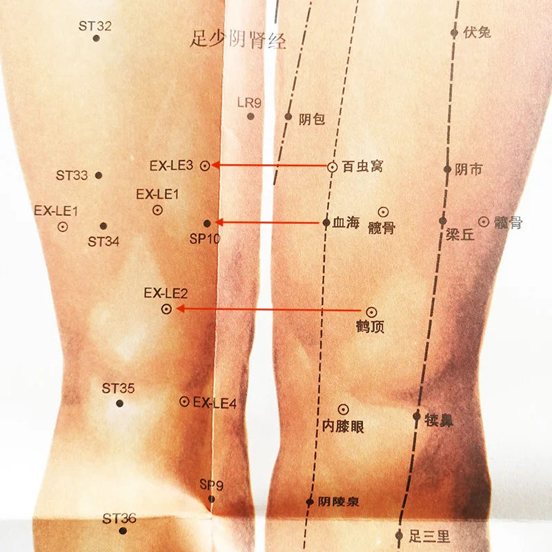 6 шт./компл. двуязычные акупунктурные диаграммы и инструкции по анатомическим схемам международной стандартизированной акупунктурной книги