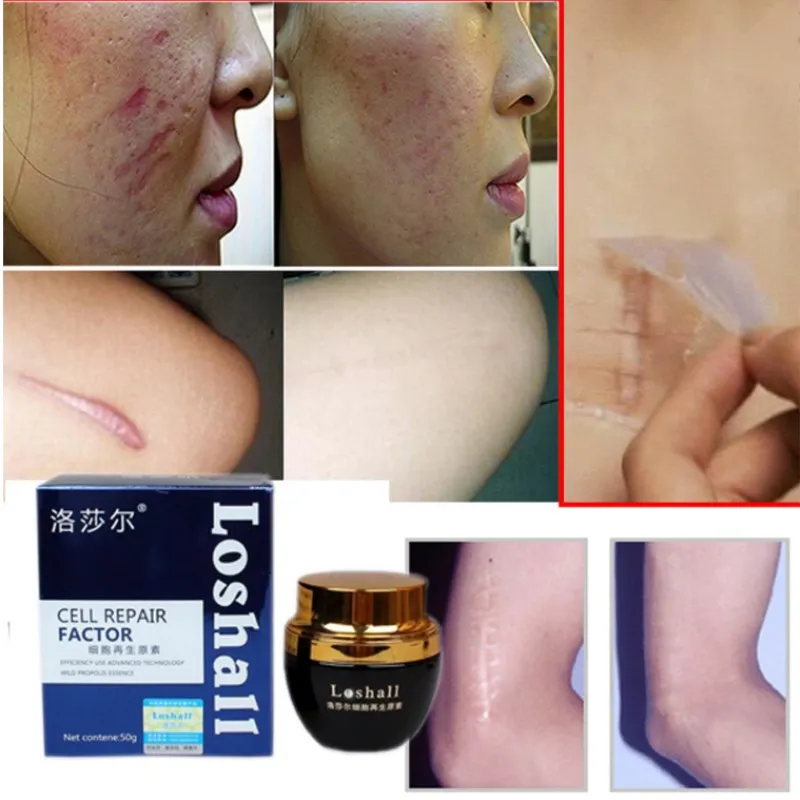 

Cell Repair Factor for Stretch Mark Scar Removal Massage Propolis Ginger Flower Centella Rose Oil Moisturizing Skin Repair Cream