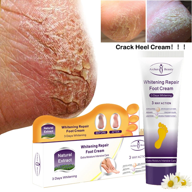 anti crack heel cream