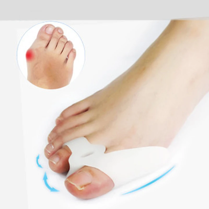 2Pair Foot Bones Silicone Toes Separator Bunion Corrector Big Toe Foot Care Pain Foot Hallux valgus Orthotics Corrective Insole