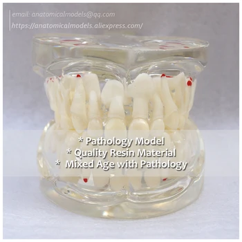 

DH/13061, Transparent Pathology Primary Teeth Model, Mixed Age Dental, Medical Science Educational Teaching Anatomical Models