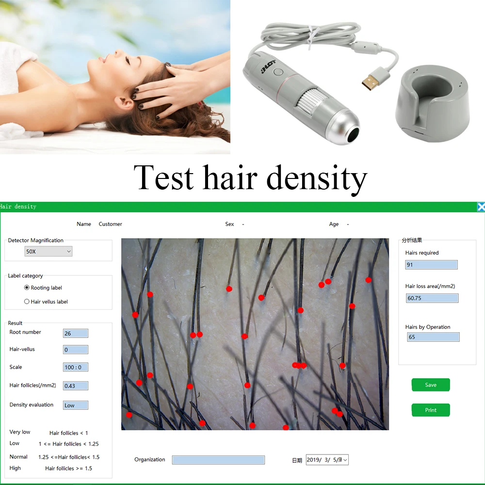 Горячая HT-B30S 5-200X Регулируемый HD скин и волосяными фолликулами прибор для исследования кожи волосистой части головы Беспроводной бытовой