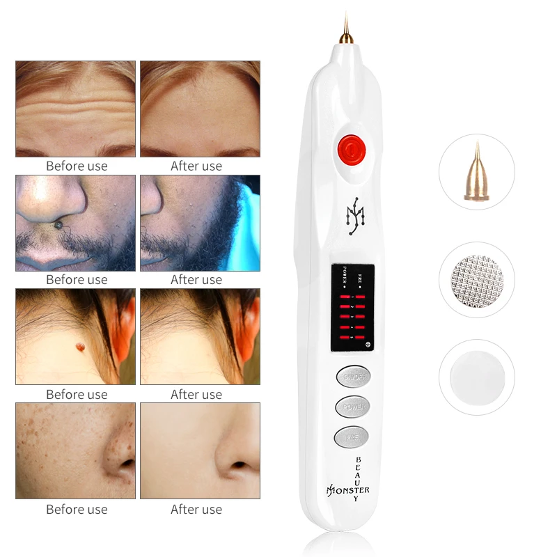 

Micro Plexr Plasma feather eyelids freckles acne dark skin place remover face tattoo removal machine Picosecond pulse therapy