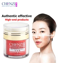 Authentic freckle Removal Cream Herbal dark spots remove Chloasma Melanin Reduces Age Spots freckle whitening cream Skin Care