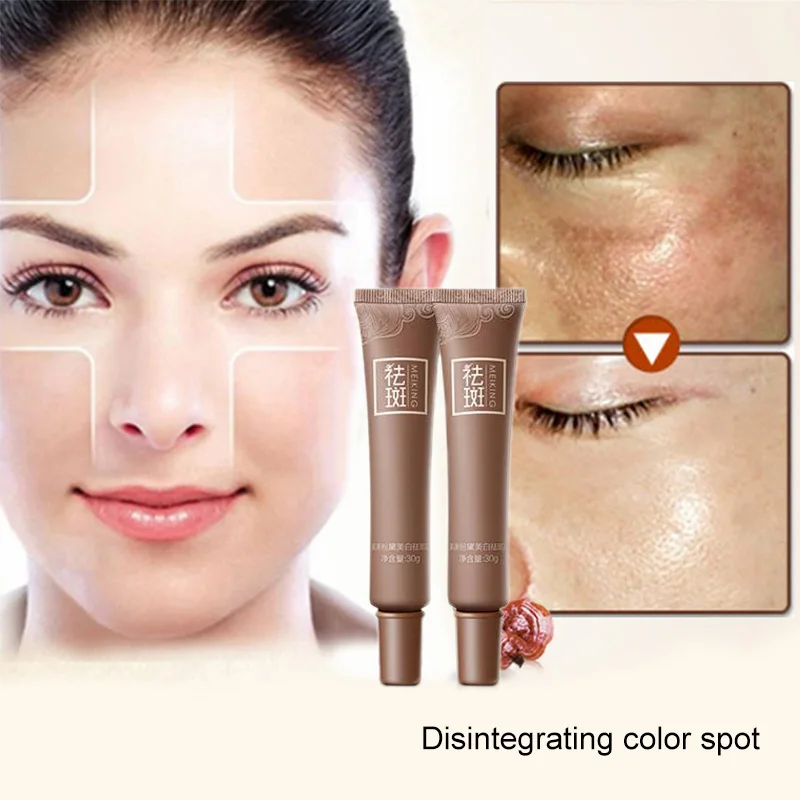 

Skin Care Age Spot Melasma Remove Freckle Face Cream Whitening Lightening 998