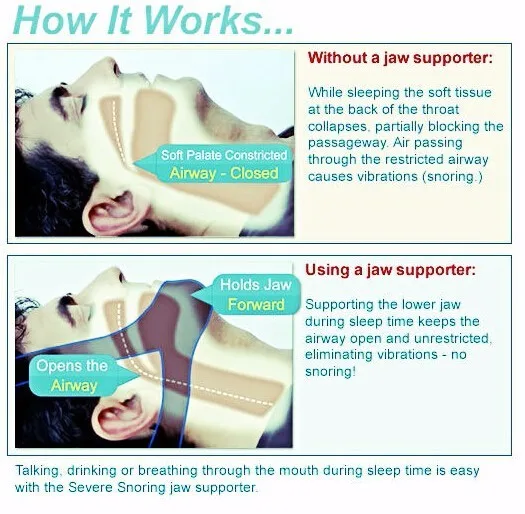 HTB1jLKQFVXXXXcEXpXXq6xXFXXXE