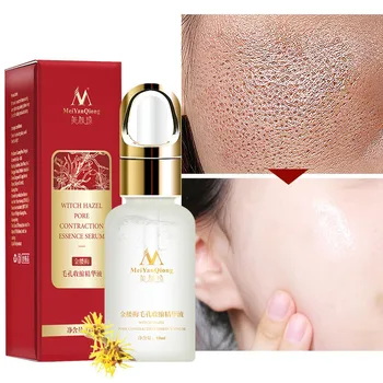 

Witch Hazel Pore Refining Serum Cleansing Pore Exfoliating Whitening Skin Replenishing Skin Moisture Facial
