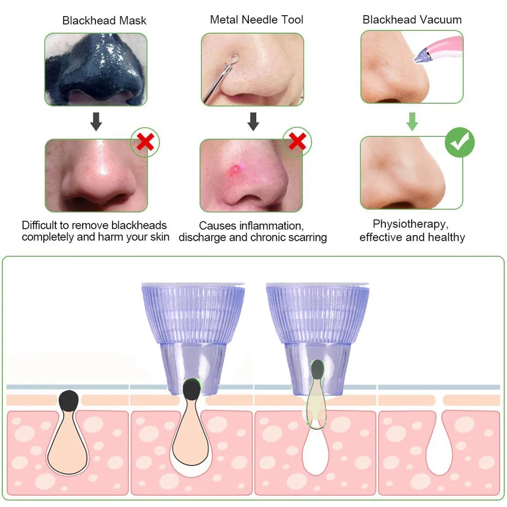 Blackhead Vacuum Acne Cleaner Pore Remover Electric Skin Facial Cleanser Care