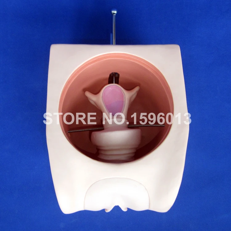 T33B contraception model (2)