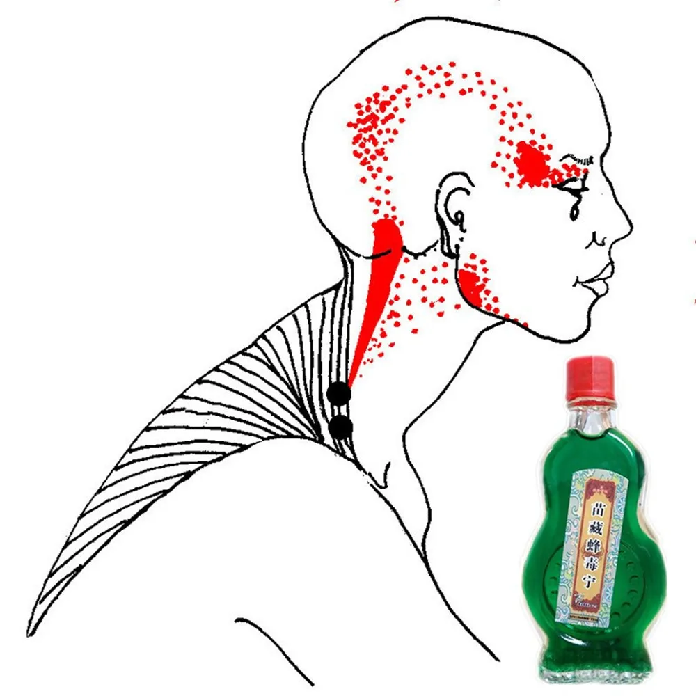 

Essential oil Cure Rheumatism Arthritis Chinese Pain relief patch orthopedic plasters analgesic patches Shoulder Massage Oil