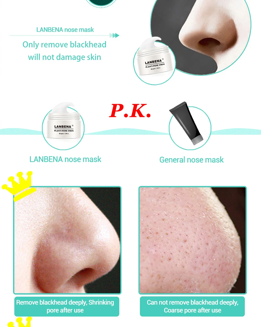 Removedor de Cravo Tratamento da Acne Controle de Óleo de Limpeza Descamação Máscara Lanbena Nariz Pore Faixa Preta Profunda Facial 5 Pcs 9 High Quality Beleza e saúde