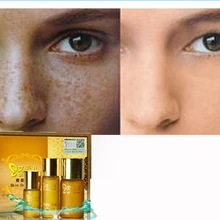 Sploshes капли крем для лица Speckles веснушки удалить бесшовные водонагреватели удалить моли удаление оптом