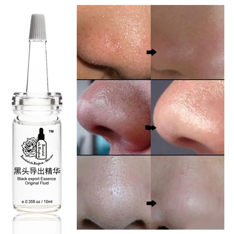 

10ml*2pcs Facial Blackheads Exporting Liquid Dissolves Blackheads Acne Moisturizing Factory Direct Sale Black Export Essence