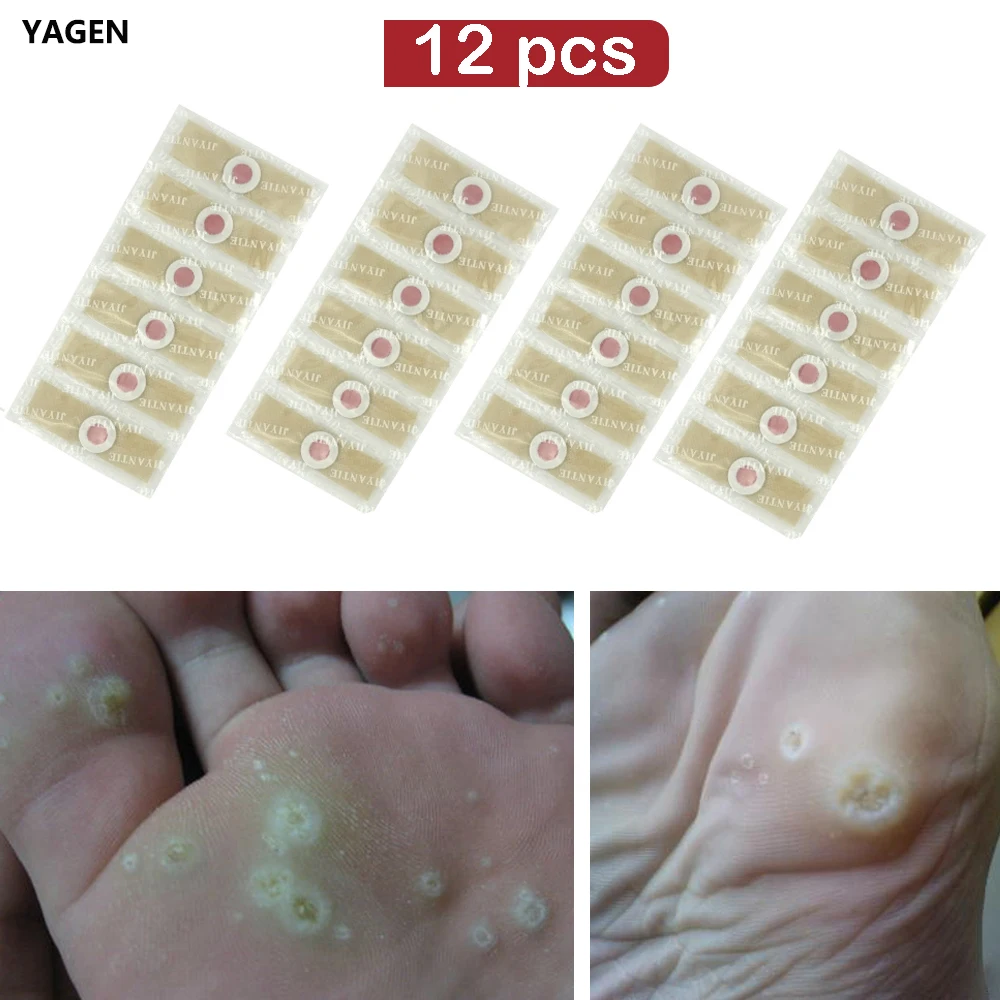

36pcs Chinese Medical plaster Foot Corn Removal Warts Thorn Plaster Calluses Callosity Detox Foot Pads Patches Curative Plasters