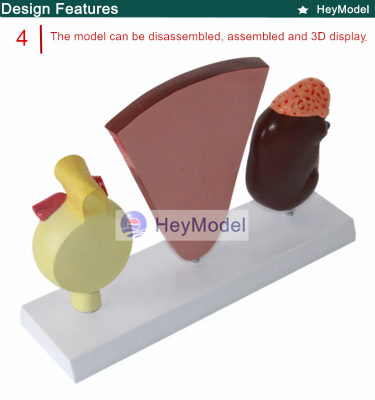 4 _