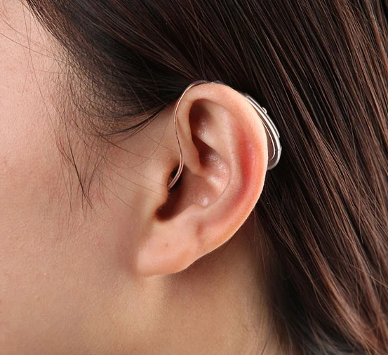  Intelligent Multi-core 20 Channels 20 Bands 4 Programs Built-in Tinnitus Masker Digital Mini Open E