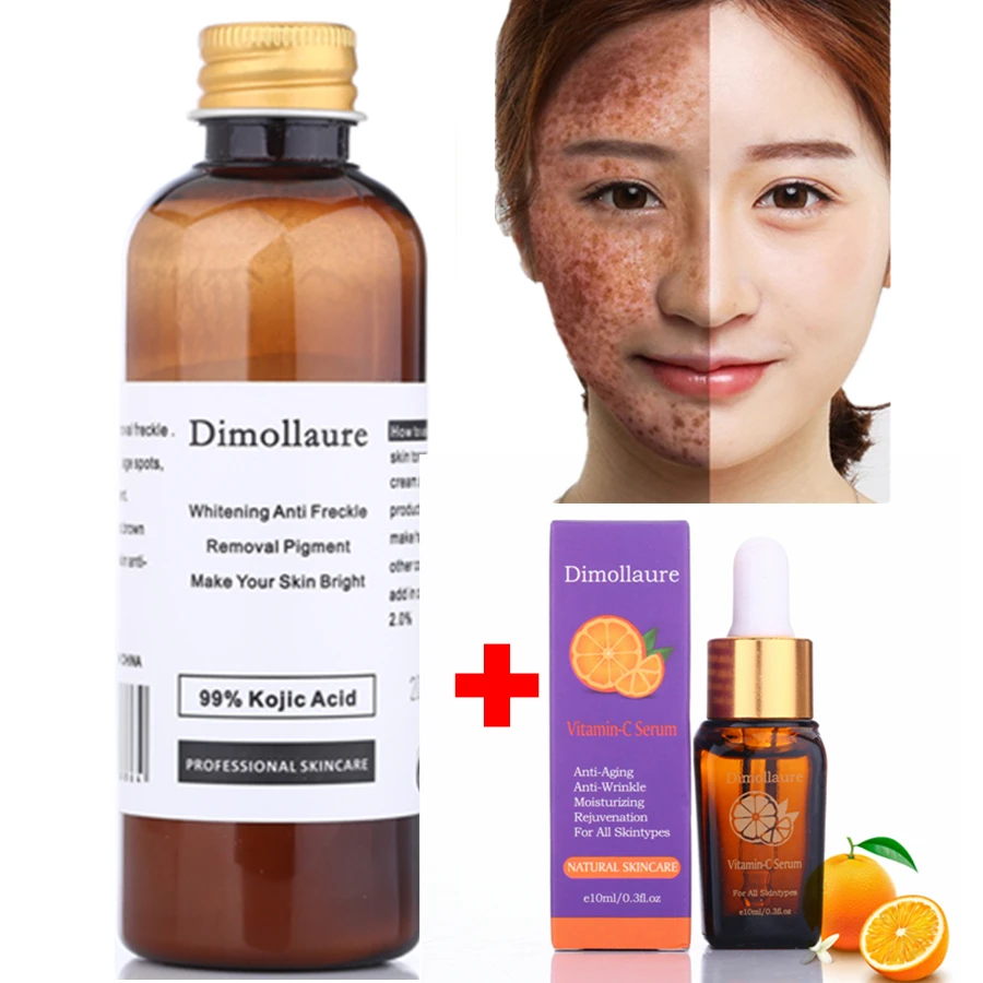 

Dimollaure 30g pure Kojic Acid whitening cream+Vitamin C serum removal Acne Pimples Anti Aging pigment melanin Wrinkle cream