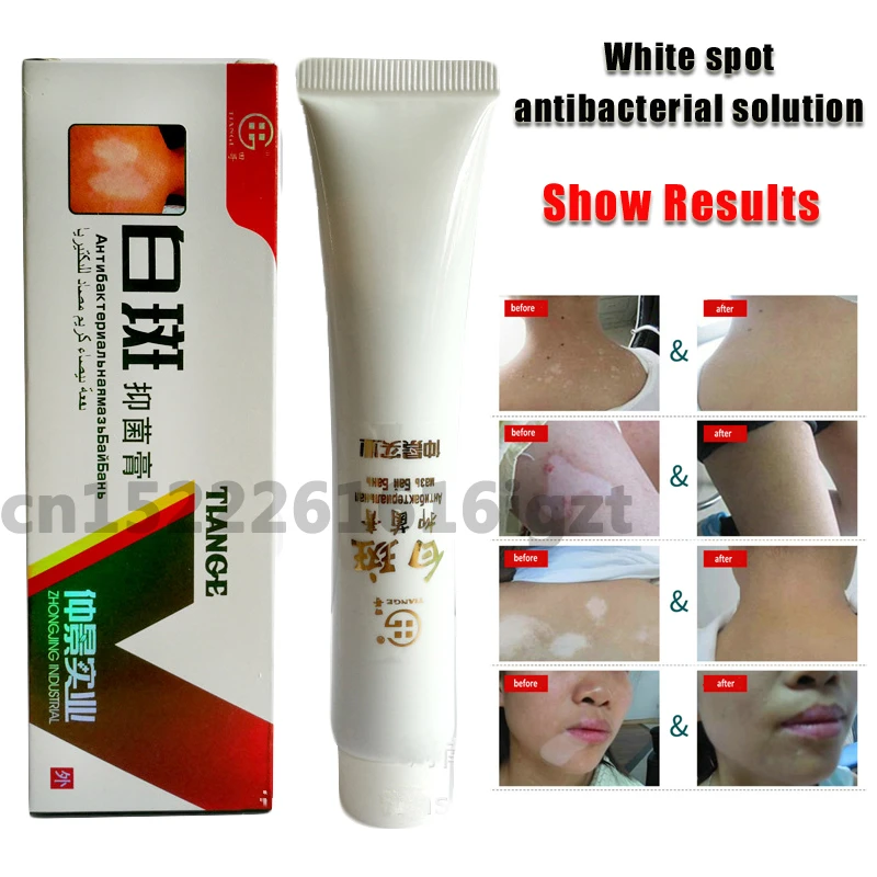 creams for combination skin