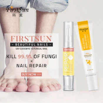 

Firstsun Toe Anti Nail Fungus Infection Treatment Cream Herbal Onychomycosis Paronychia Treatment Nail Podiatry Repair Pen