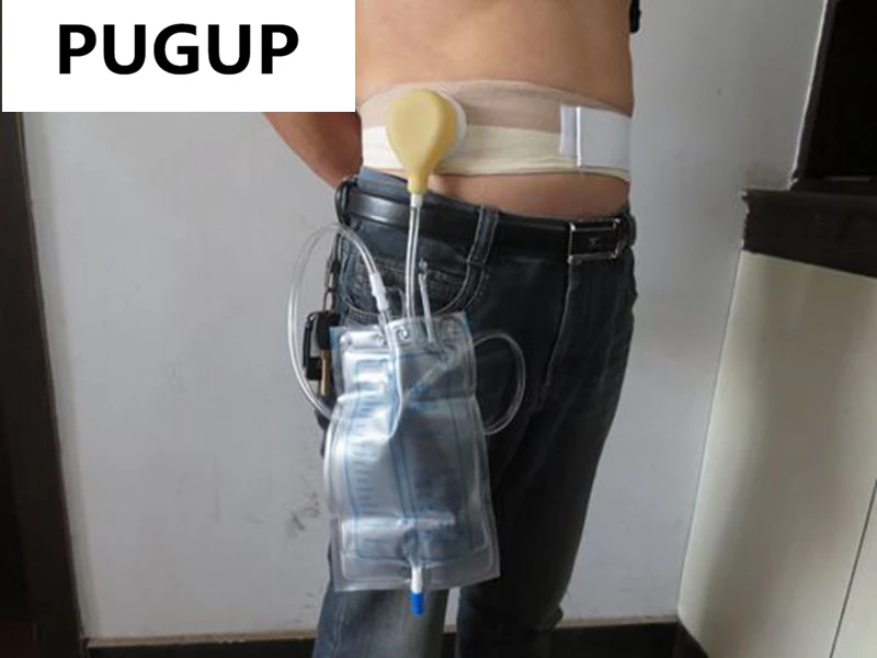 Bolsa de orina para hombre o mujer, Colector de orina de goma para lado