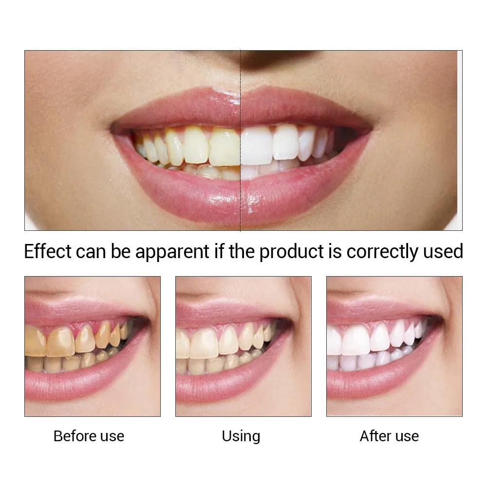 Denture cleaner removes anal stains read this Confirm. Denture cleaner removes anal stains consider, that