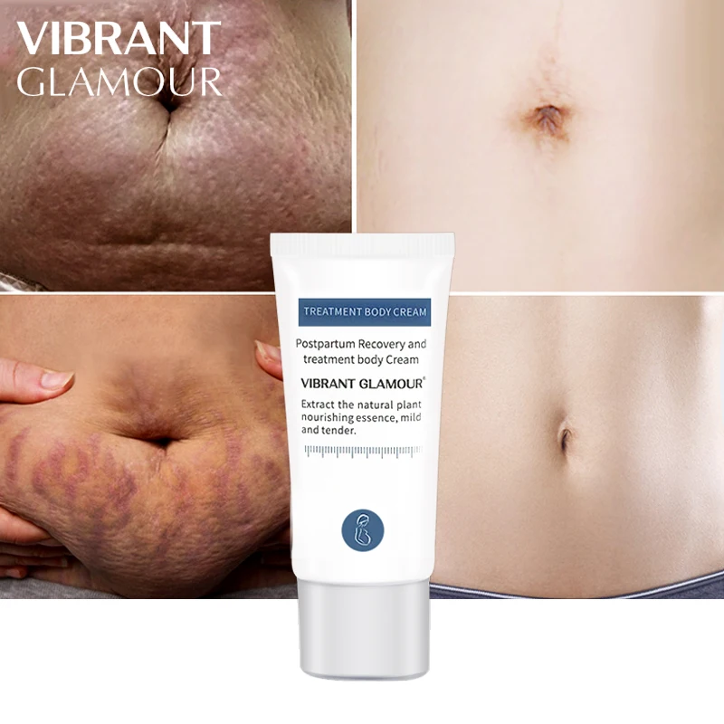 VIBRANT GLAMOUR cocodrilo estiramiento marcas removedor crema cicatrices de embarazo Ance maternidad reparación Anti envejecimiento Winkles reafirmante cuidado corporal