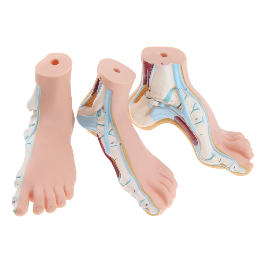 1:1 Life Size Human Foot Platypodia Bow Foot Anatomy Model Muscle Vascular