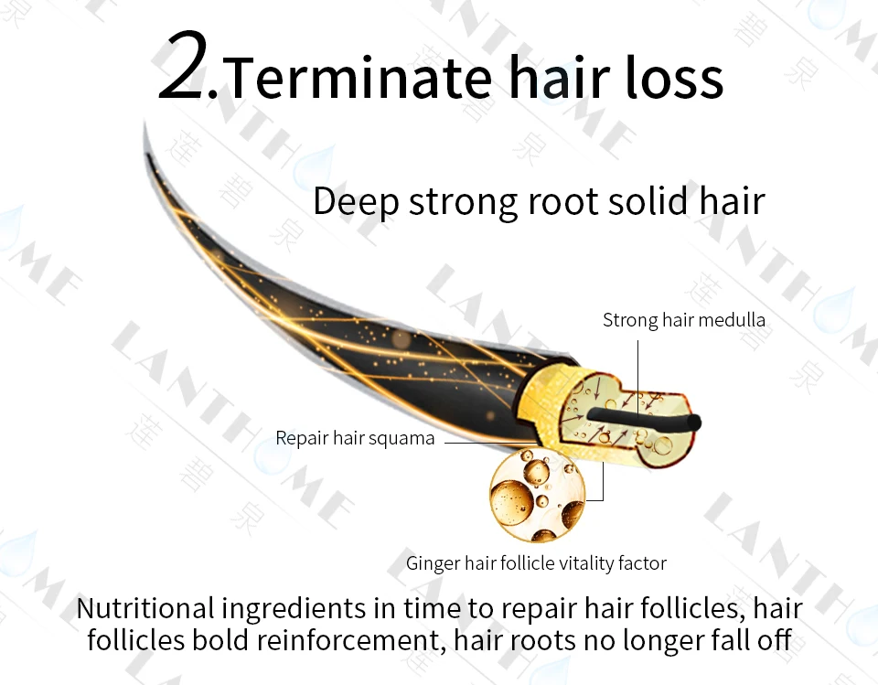Lanthome, эссенция для роста волос, имбирь, стоп, уход за волосами, быстрый рост, уникальные продукты, Тонизирующее масло, ЖИДКОЕ, уход за здоровьем