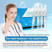 4x3 мл Лечение ногтей от грибка ручка Onychomycosis Paronychia противогрибковые инфекция ногтей китайский травяной TSLM1