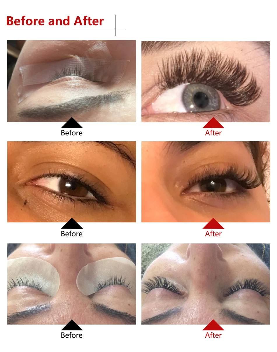 before after