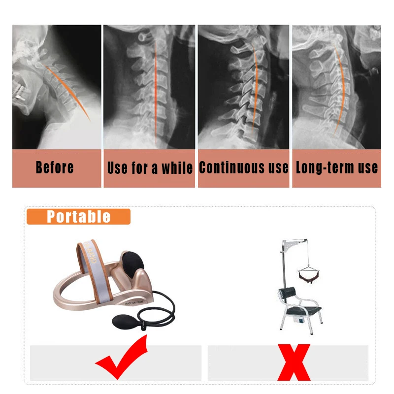 OPHAX الهوائية المحمولة فقرة الرقبية جرار المنزل الرعاية الصحية الموقف مضخة الرقبة مدلك العمود الفقري الجر العضلات لتخفيف الآلام
