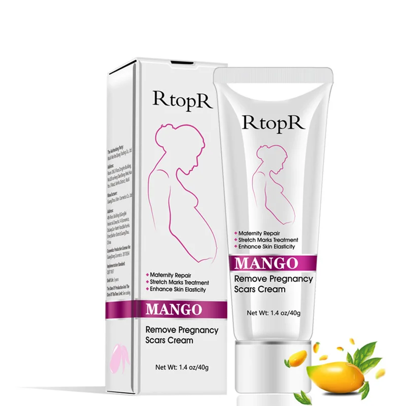 RtopR Natural Mild Non-irritating Mango Stretch Mark Cream Pregnancy Repair Scar Slack Line Abdomen Stretch Marks Cream TSLM1