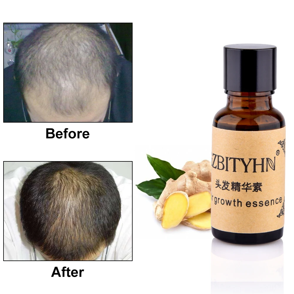 20ml 100 Natural Extract Hair Growth Essence Oil Liquid Prevent