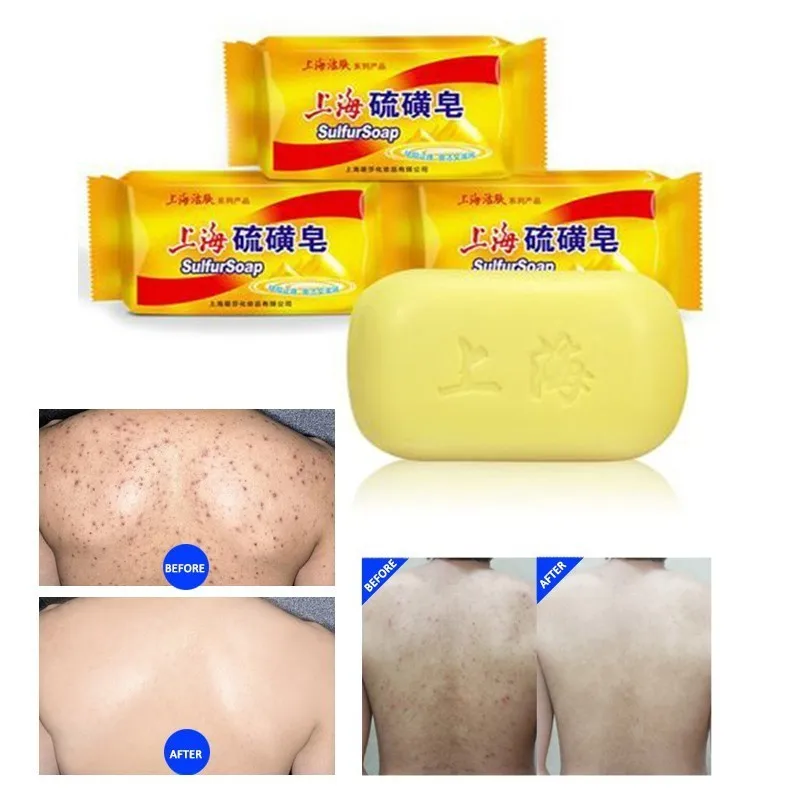 

Shanghai Sulfur Soap Killing Mites Oil Control Anti-acne Whitening Relieve Itching Facial Cleanser Hand Soap Soap Gift 90g/pcs