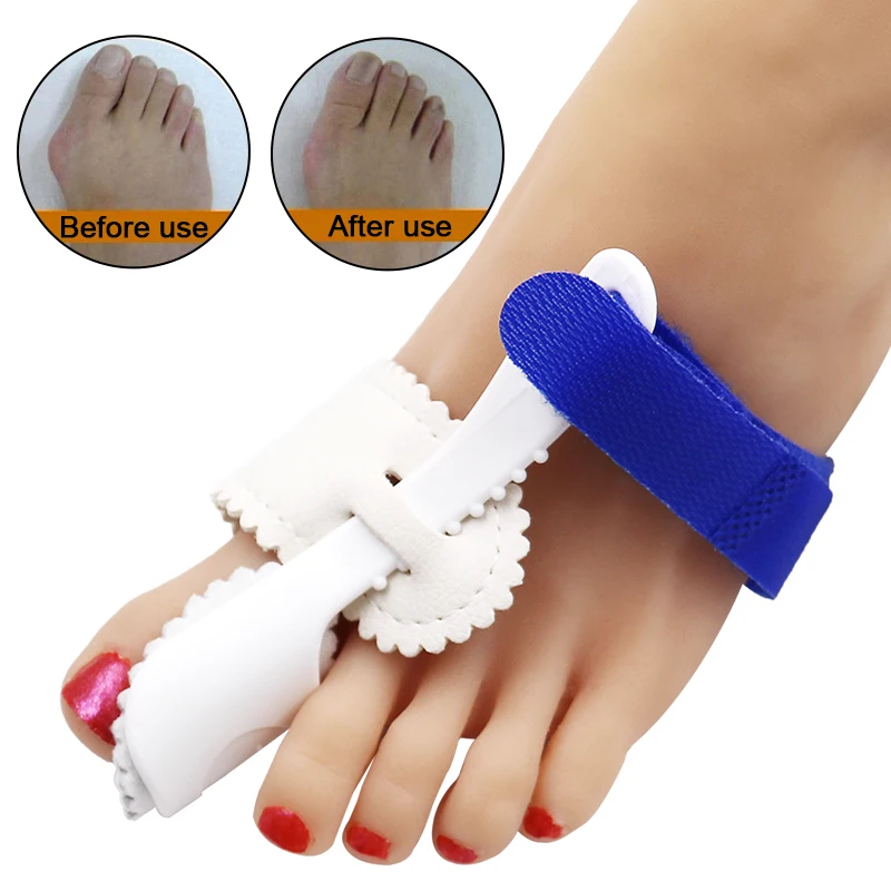 Bunion Device Hallux Valgus Orthopedic Braces Toe Correction Night Foot Care Corrector Thumb Goodnight Daily Big Bone Orthotics