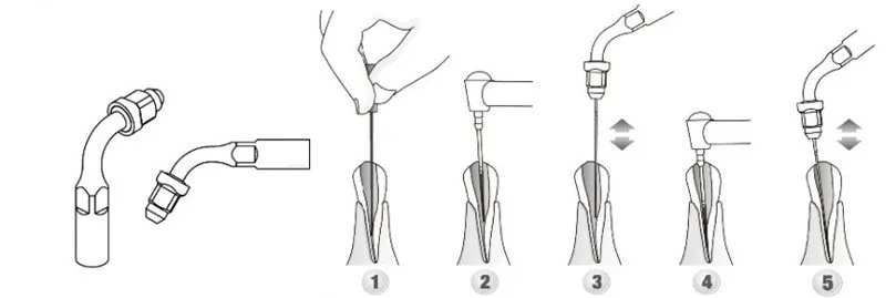 1 набор стоматологических наконечников Endo Kit EEKS fit EMS дятел SYBRONENDO с Endo Tip Endodontic instrument