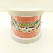 Dental Orthodontic Treatment Model With Ortho Metal Ceramic Bracket Arch Wire Buccal Tube Ligature Ties