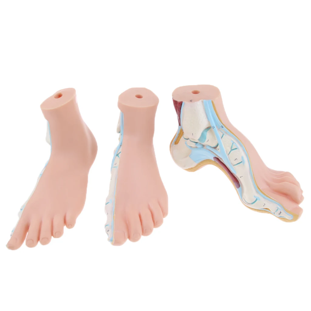1:1 Life Size Human Foot Platypodia Bow Foot Anatomy Model Muscle Vascular