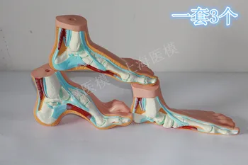 

3 pcs Foot muscle Anatomical model Normal foot Flat feet Bow-shaped foot model
