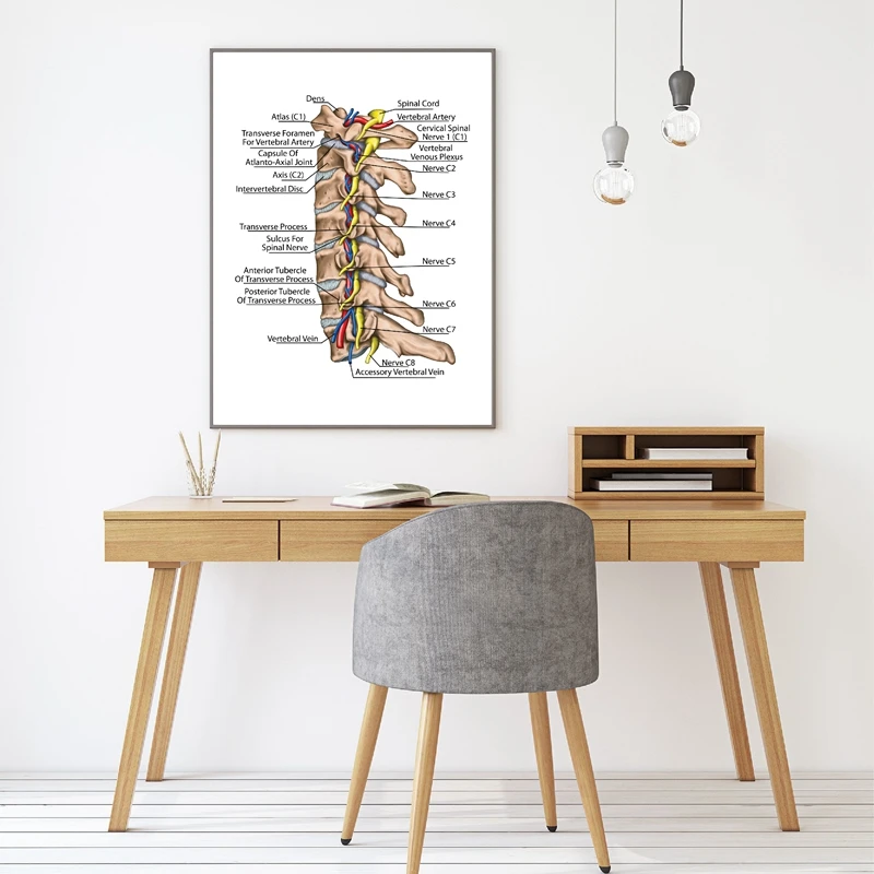 Topographic relationship of the spinal nerve and vertebral artery prints