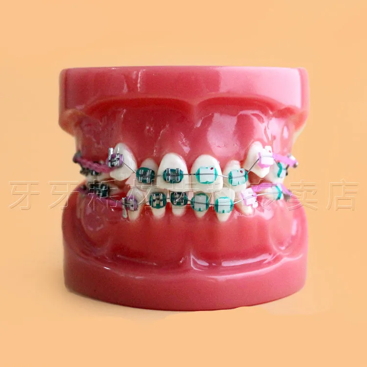 

2018 New Arrival New Orthodontic Model Teeth With Half Metal Bracket and Half Ceramic for School Training