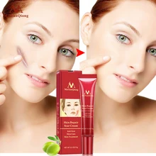 15 г восстанавливающий крем для лица Удаление Шрама от акне крем против акне пятна лечение акне отбеливание чёрных точек крем противошрамный растяжки