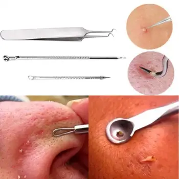 

3Pcs Stainless Blackhead Facial Acne Spot Pimple Remover New Arrival Extractor Tool Comedone Set 1J17 6