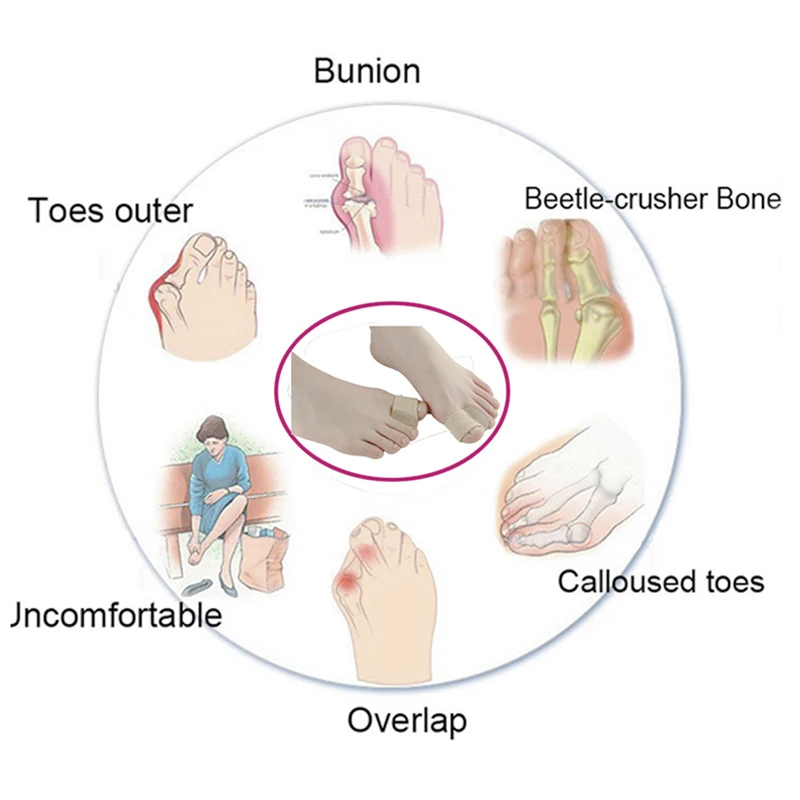 Разделитель для коррекции большого пальца, защита от буйона, корректор вальгусной деформации, силиконовый выпрямитель для пальцев ног, инструмент для ухода за ногами P0108