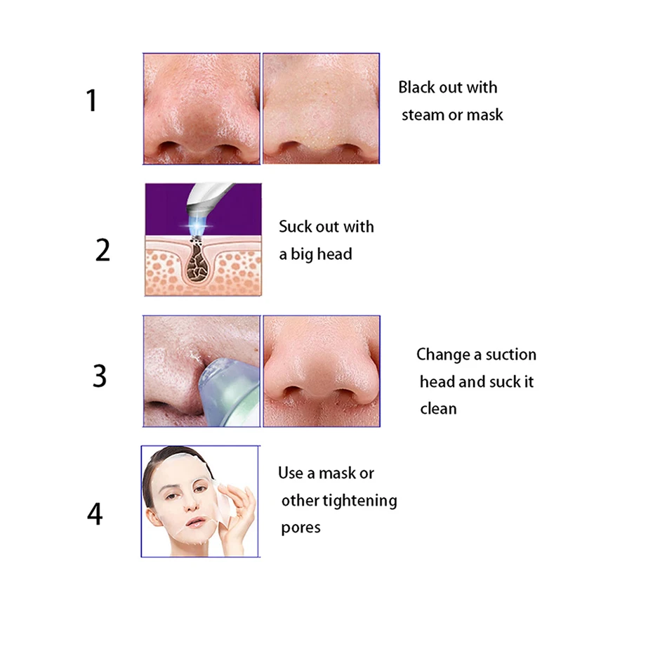 Электрический вакуумный прибор для удаления черных точек и гвоздики инструмент для удаления угрей вакуумный аппарат для очистки пор