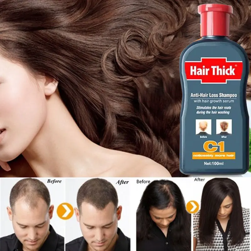Herbs 100ml Anti Hair Loss Liquid Natural Hair Growth Extention