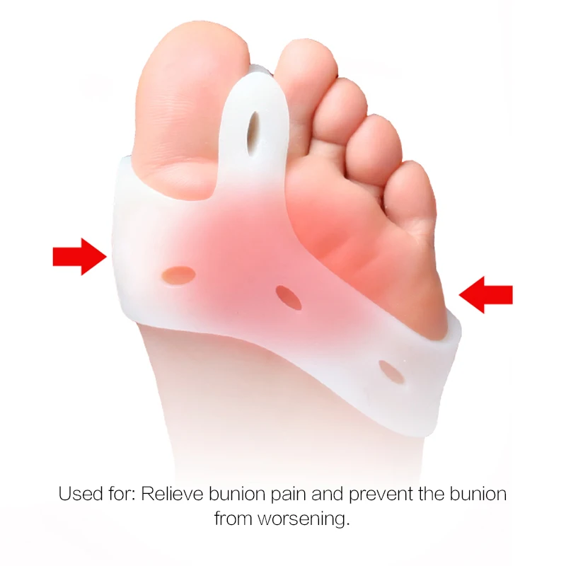 1 пара = 2 шт, корректор вальгусной деформации большого пальца стопы, ортопедическая скобка, силиконовый разделитель большого пальца, ортопедические коврики