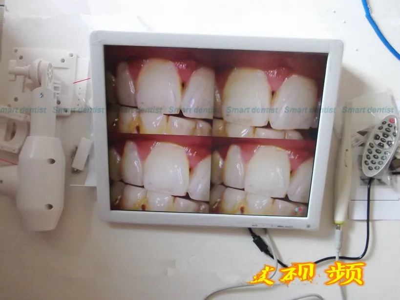 Бороскоп для стоматологического эндоскопа с высоким разрешением 17 дюймов ЖК-монитор