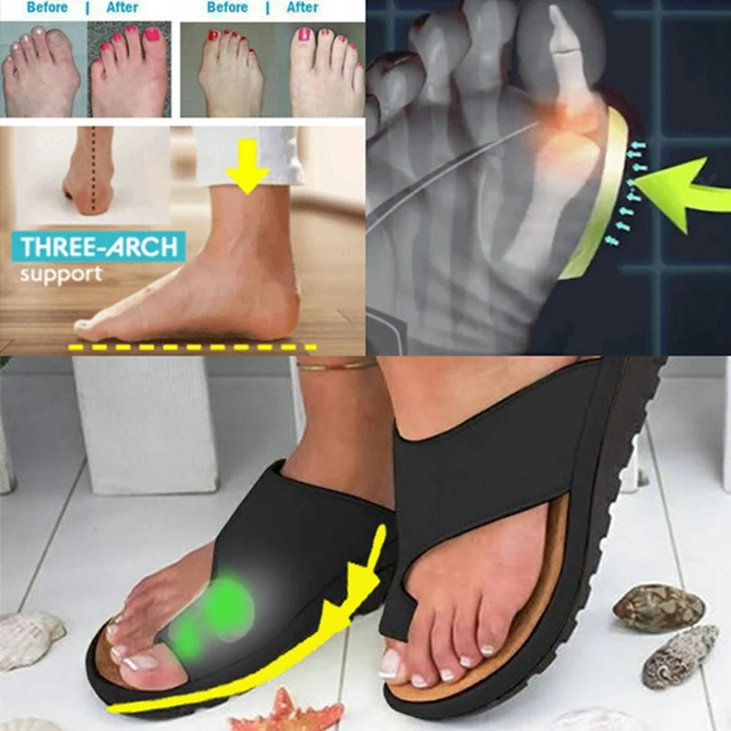 

LOOZYKIT 2019 Casual Nuevo Flat Bottom Big Toe Chaussures Female Non-slip Women Sandals Plus Size Sandals Shoes Summer Zapatilla