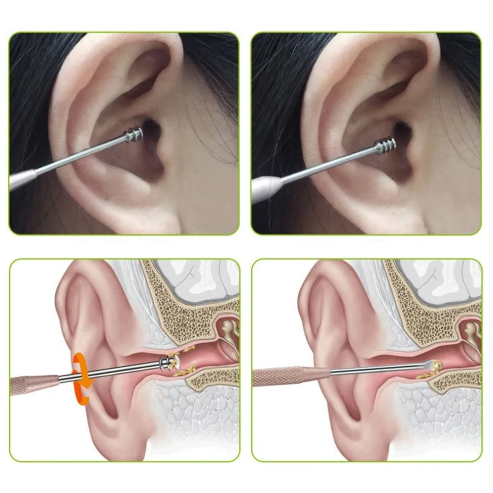 Ушные палочки с двойной головкой для удаления ушной серы, Кюретка, медицинский класс, гигиена ушей, инструмент для чистки ушей из нержавеющей стали, наборы для ухода